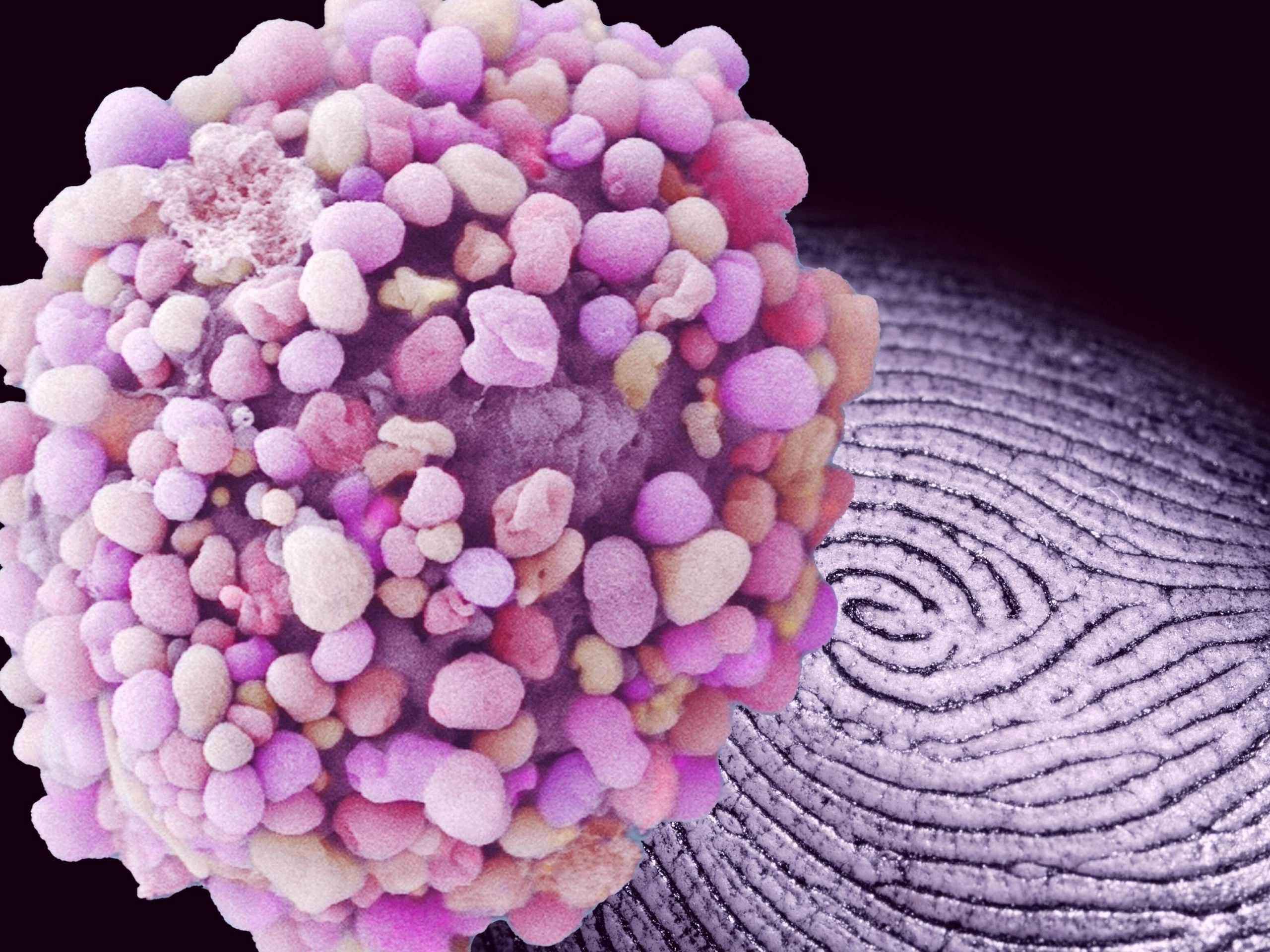 固体、液体、またはガス?視覚的な「指紋」は、組織と癌腫瘍の物理的状態を迅速に識別します