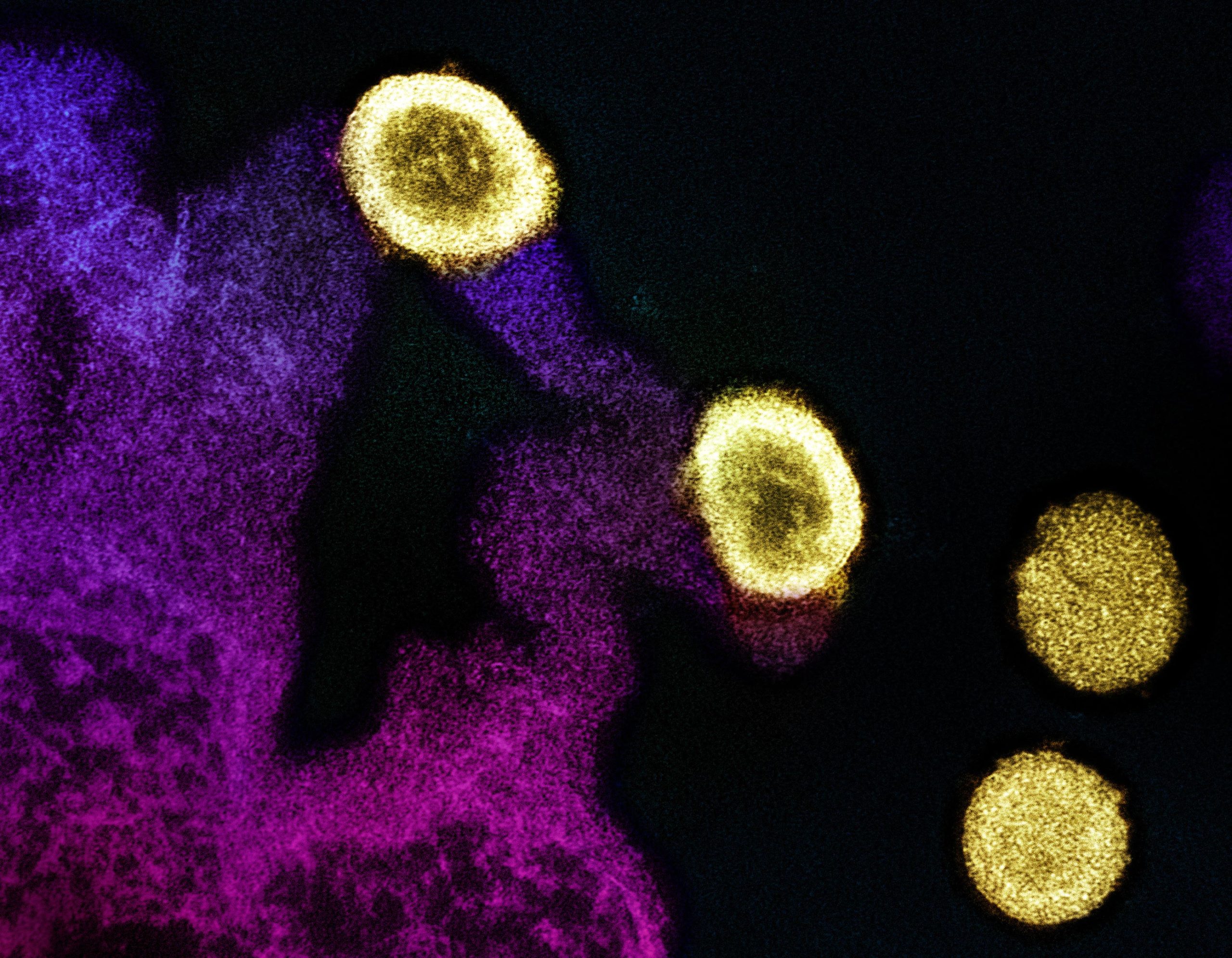 消失脂肪：HIV肝疾患に対するセマグルチドの勝利