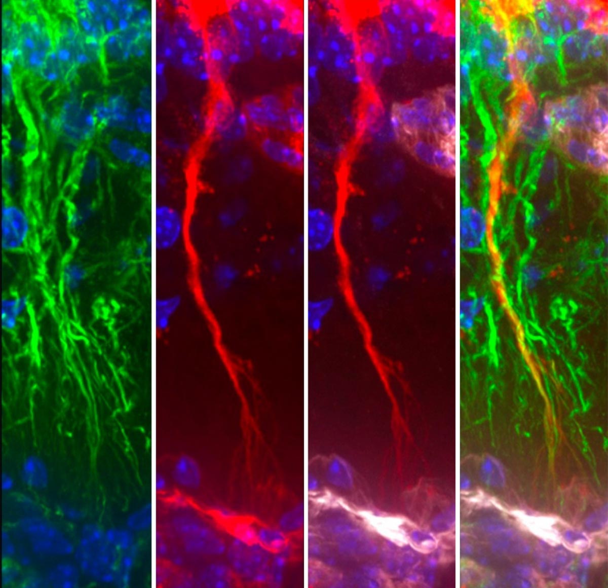 科学者たちは、有毒なアルツハイマー病タンパク質を除去する隠れた脳細胞を発見